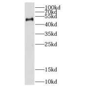 WB analysis of HL-60 cells, using CREB3L4 antibody (1/500 dilution).