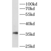 WB analysis of rat testis tissue, using CREM antibody (1/300 dilution).