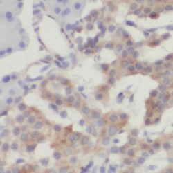 CRH / CRF Antibody