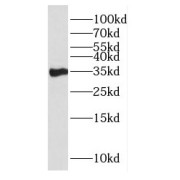 WB analysis of human brain tissue, using CRH antibody (1/400 dilution).