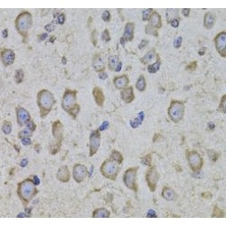 Corticotropin Releasing Hormone Receptor 1 (CRHR1) Antibody