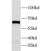 WB analysis of HeLa cells, using CRHR1 antibody (1/1000 dilution).