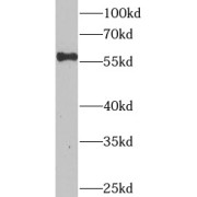 WB analysis of mouse skeletal muscle tissue, using CRHR2 antibody (1/600 dilution).