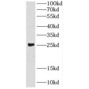 WB analysis of mouse heart tissue, using CRIP2 antibody (1/1500 dilution).