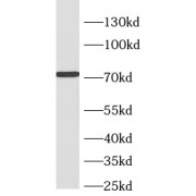 WB analysis of HepG2 cells, using CRTC2, TORC2 antibody (1/300 dilution).