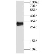 WB analysis of C6 cells, using CRYBB1 antibody (1/1000 dilution).