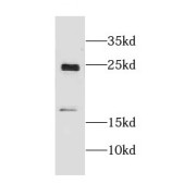 WB analysis of mouse eye tissue, using CRYGN antibody (1/300 dilution).