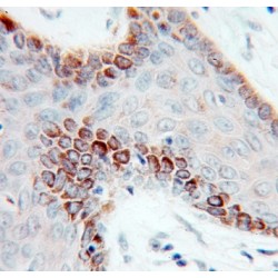 Cold Shock Domain Containing Protein E1 (CSDE1) Antibody