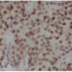 Chromosome Segregation 1 Like (CSE1L) Antibody