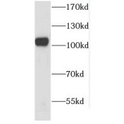 WB analysis of HeLa cells, using CSE1L antibody (1/1000 dilution).