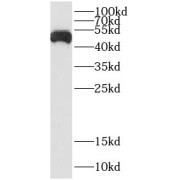 WB analysis of HepG2 cells, using CSF2RA antibody (1/600 dilution).