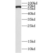 WB analysis of K-562 cells, using CSGALNACT2 antibody (1/800 dilution).