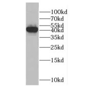 WB analysis of MCF7 cells, using CSNK1A1 antibody (1/1000 dilution).