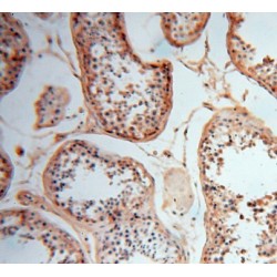 Casein Kinase I Isoform Alpha-Like (CSNK1A1L) Antibody