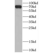 WB analysis of HeLa cells, using CSNK1A1L antibody (1/1000 dilution).