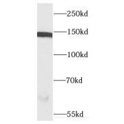 WB analysis of Jurkat cells, using CSPP1 antibody (1/200 dilution).