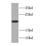 WB analysis of human stomach tissue, using CSRP1 antibody (1/500 dilution).