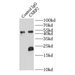 Cysteine And Glycine Rich Protein 2 (CSRP2) Antibody