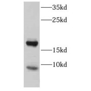 WB analysis of human testis tissue, using CST8 antibody (1/1000 dilution).