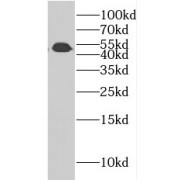 WB analysis of HeLa cells, using CSTF1 antibody (1/1000 dilution).