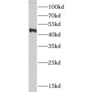 WB analysis of MCF7 cells, using CTBS antibody (1/400 dilution).