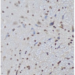 Transcriptional Repressor CTCF (CTCF) Antibody