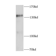 WB analysis of human brain tissue, using CTCF antibody (1/1000 dilution).