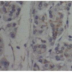 CTD Small Phosphatase Like Protein 2 (CTDSP2) Antibody