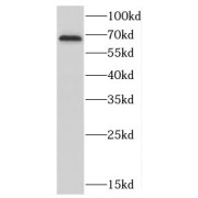 WB analysis of MCF7 cells, using CTDSPL2 antibody (1/500 dilution).