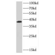 WB analysis of mouse heart tissue, using CTGF antibody (1/600 dilution).