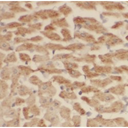 Connective Tissue Growth Factor (CCN2) Antibody