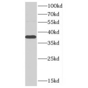 WB analysis of mouse heart tissue, using CTGF antibody (1/600 dilution).