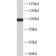 WB analysis of NIH/3T3 cells, using CTNNA1 antibody (1/1000 dilution).