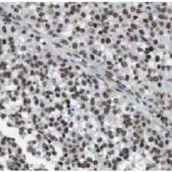 Beta-Catenin-Like Protein 1 (CTNNBL1) Antibody