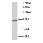 WB analysis of Jurkat cells, using CTNNBL1 antibody (1/500 dilution).