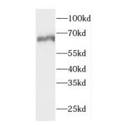 WB analysis of HeLa cells, using CTP synthase antibody (1/500 dilution).