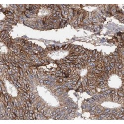 Complement C1q Tumor Necrosis Factor-Related Protein 1 (CTRP1) Antibody