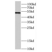 WB analysis of HeLa cells, using CUGBP1 antibody (1/200 dilution).