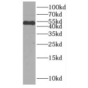 WB analysis of K-562 cells, using CUGBP2 antibody (1/300 dilution).
