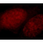 IF analysis of HepG2 cells, using CUX1 antibody (1/25 dilution) and Rhodamine-conjugated goat anti-rabbit IgG (red).