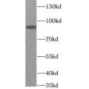 WB analysis of PC-3 cells, using CX3CL1 antibody (1/1000 dilution).