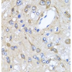 Chemokine C-X-C-Motif Receptor 4 (CXCR4) Antibody