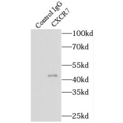 Chemokine C-X-C-Motif Receptor 7 (CXCR7) Antibody
