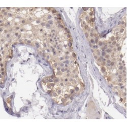 Cytochrome B5 Type B (CYB5B) Antibody