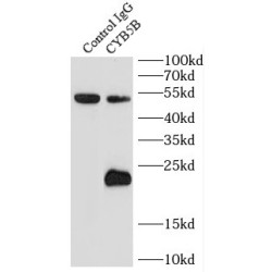 Cytochrome B5 Type B (CYB5B) Antibody