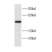 WB analysis of mouse lung tissue, using CYB5B antibody (1/500 dilution).