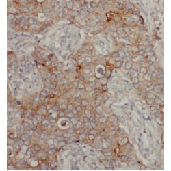 Cytochrome B5 Reductase 1 (CYB5R1) Antibody