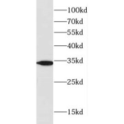 WB analysis of human placenta tissue, using CYB5R1 antibody (1/500 dilution).