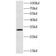 WB analysis of HepG2 cells, using CYB5R3 antibody (1/1000 dilution).