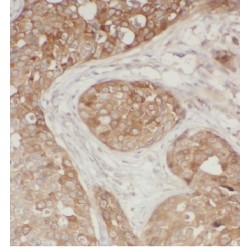 Cytochrome C1 (CYC1) Antibody